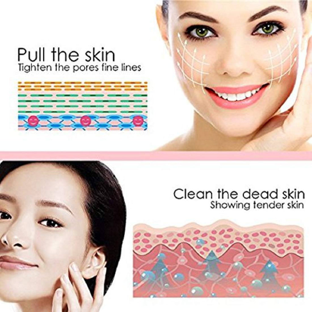 Acne Pore Vacuum Cleaner Blackhead Remover - Pink Only