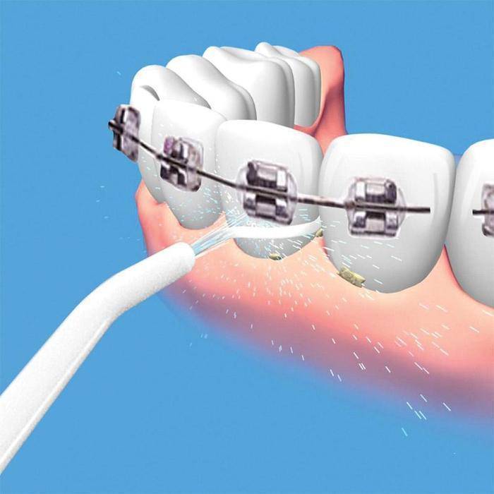 Power Floss Dental Water Jet