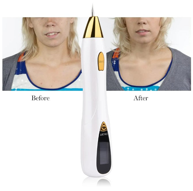 Skin Care Laser Mole, Tattoo Freckle, Wart Corns Dark Spot Removal Pen LCD - Gold