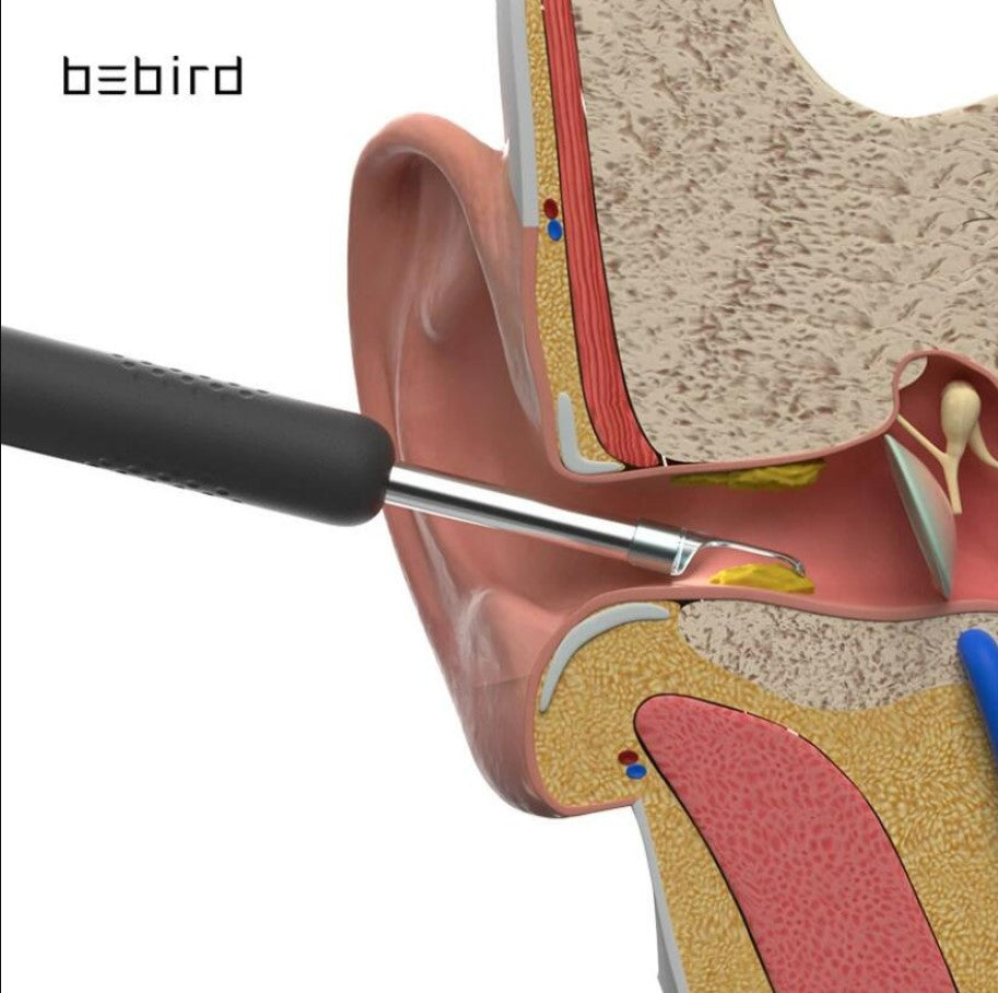 Bebird R1 Smart Visual Ear Sticks Endoscope Ear Picker Tool Set - White